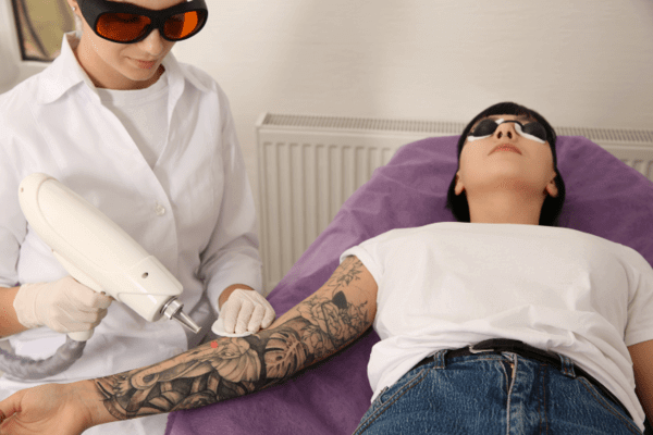 Young woman under going tattoo removal procedure.