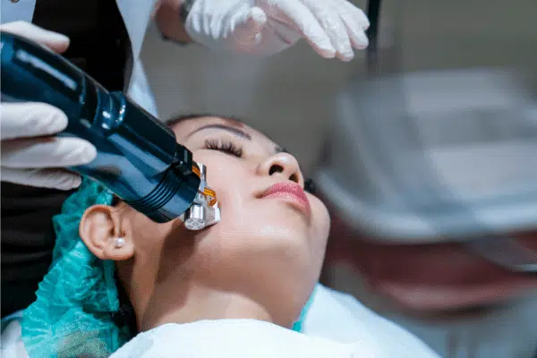 Woman is under going a radiofrequency energy treatment on her face.