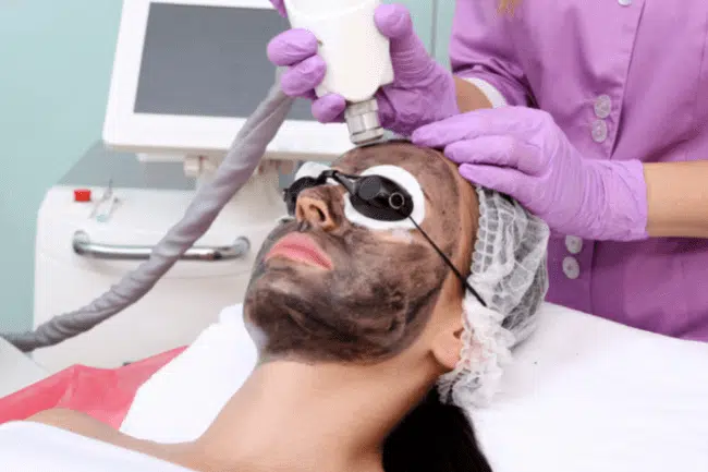 Woman doing some glamour carbon peeling treatment in the clinic.