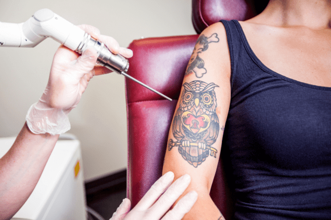 Cosmetologist doing some laser tattoo removal to the girl.