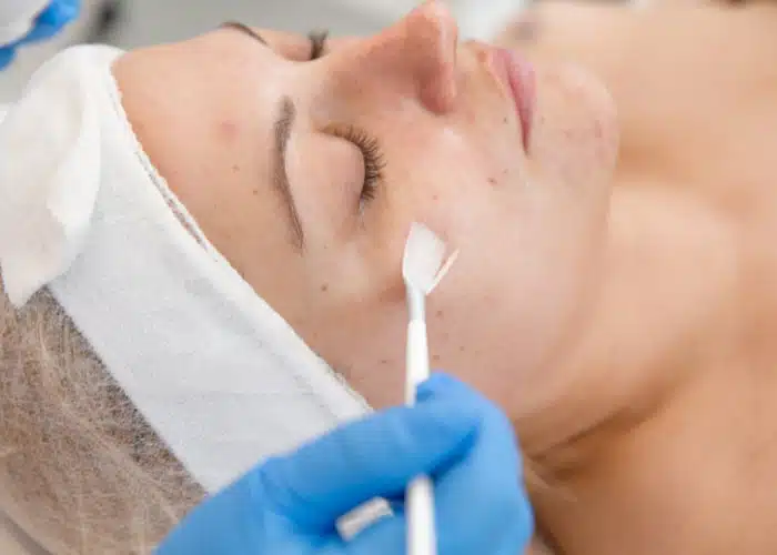 Woman having Chemical Peeling treatment at the Aesthetic clinic.