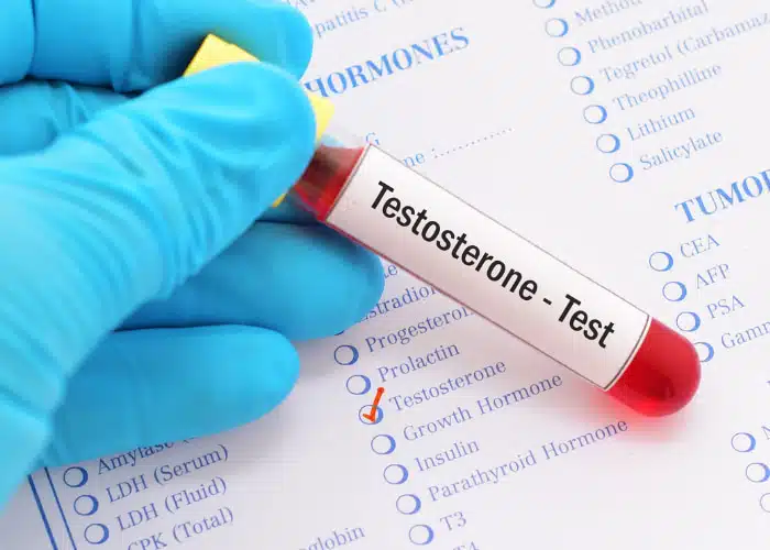 Testosterone Test concept.